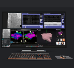 Class 1 Recall Initiated for Diamondback 360 Peripheral Orbital